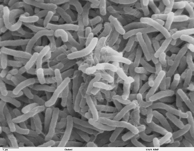 Cholera Bacterium