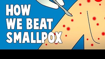 How We Conquered the Deadly Smallpox Virus - Simona Zompi